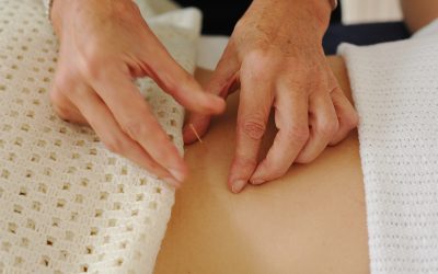 Acupuncture and Treating Anxiety